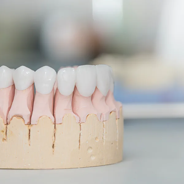 Dental-Balance-Veranstaltungen-Zirkonoxid