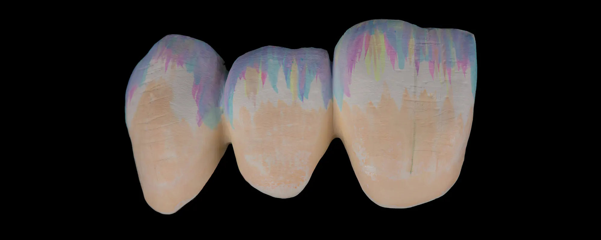 Dental-Balance-Esthetic-Colorant-slider