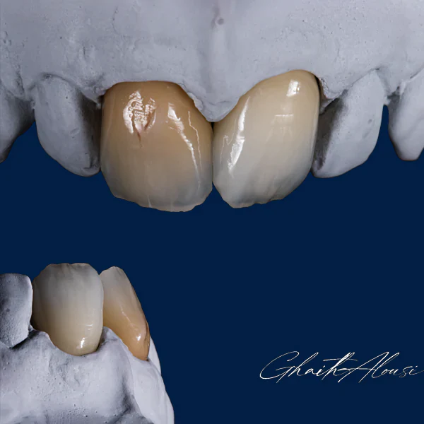 Dental-Balance-Natural-Style-Ghait-Alousi