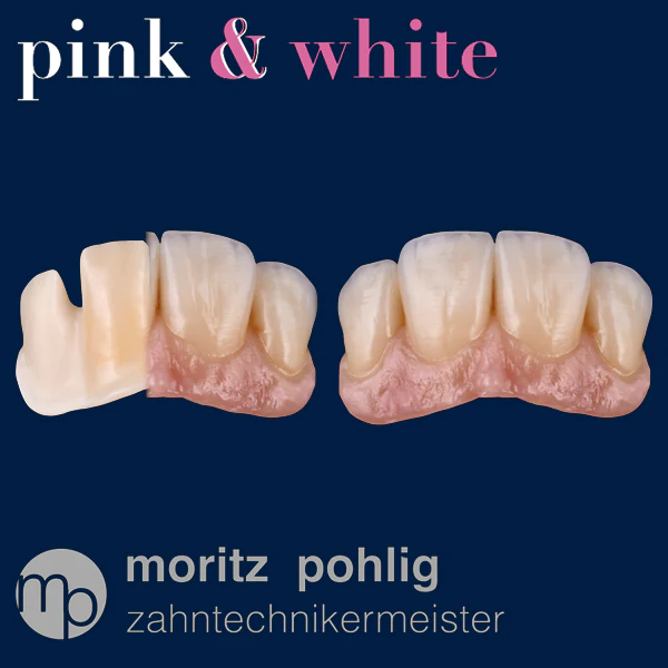 Dental-Balance-Pink-and-White