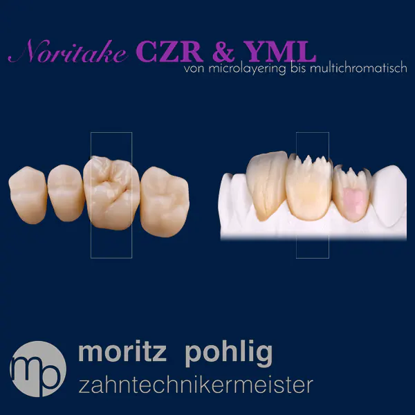 Dental-Balance-von-Microlayering-Multichromatisch
