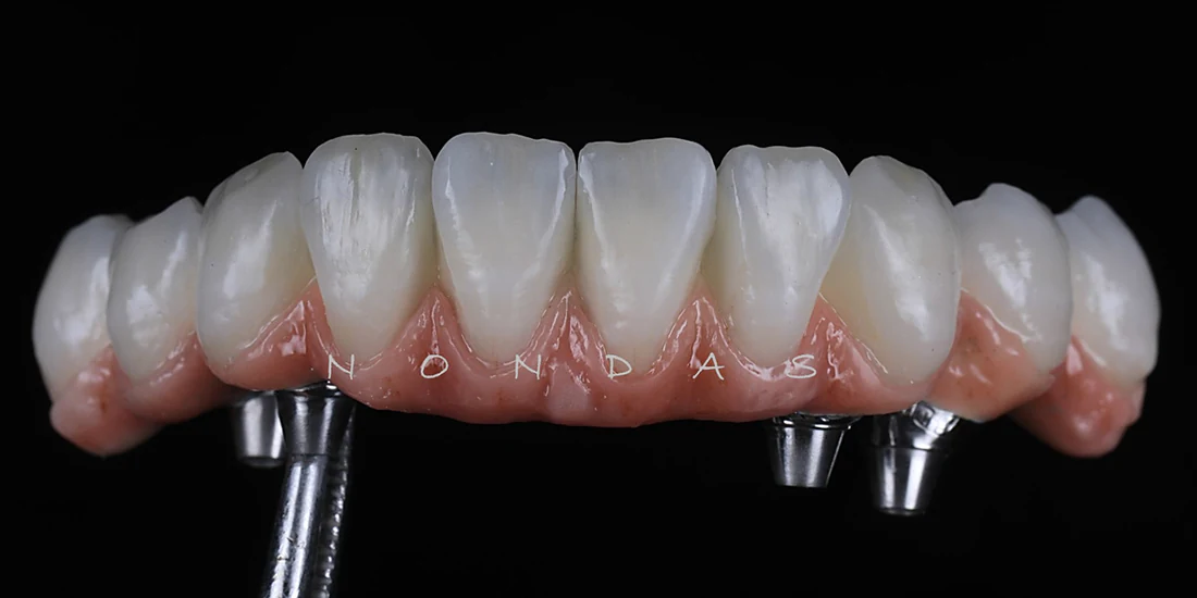 Dental-Balance-A9oyxol4_1jp1usf_kqs