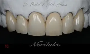 Dental-Balance-Warnemuende-Alek-Aronin-1